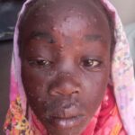 26 Human Rights Organizations and Media Platforms Call for Jebal Marrah to be Declared an Epidemic Zone